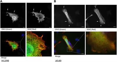 ERK3 and DGKζ interact to modulate cell motility in lung cancer cells